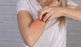 طريقة جديدة لعلاج الحساسية