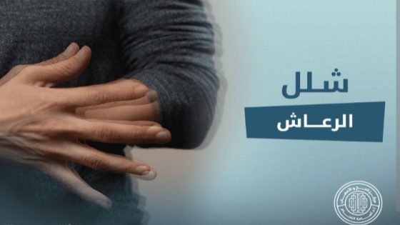 االإعاقة تتهدد آلاف المغاربة بسبب مرض الباركنسون ” شلل الرعاش”